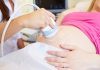 Bà bầu siêu âm nhiều có tốt không