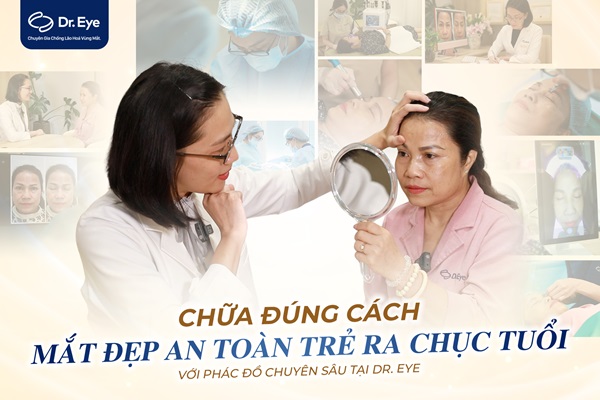 cắt mí bao lâu mới tự nhiên 